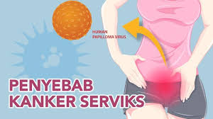 Maybe you would like to learn more about one of these? Menikah Di Usia Muda Risiko Kanker Serviks Wajib Diwaspadai