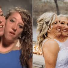 Cómo será la vida íntima de las siamesas Abby y Brittany Hensel ahora que  una se casó? Esto dice un experto - La Prensa Gráfica