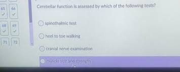 Image result for Cerebellar Function Test