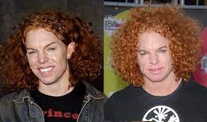 Pin On Body Modification Plastic Surgeries Gone Wrong Etc