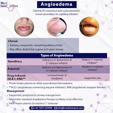 Image result for Angioedema