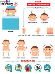 Hand Foot And Mouth Disease In Children Hand Foot And Mouth Hand Diseases Sore Throat And Headache