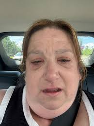 I am looking for transportation from Orlando airport to Disney resort￼