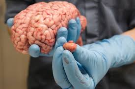 موقع أراجيك الغدة النخامية سي دة الغدد في الجسم