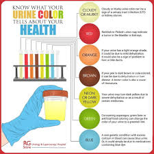 Dipstick urinalysis litfl ccc investigations. What Colour Is Your Pee Health Chart Urinal Health