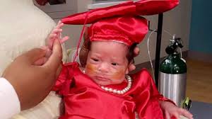 Frequently asked questions about mcallen. Baby Gets Farewell Graduation Ceremony After 80 Days In The Nicu Gma