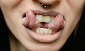 This album shows different kind of modifications than… Tongue Splitting Poses Serious Risk To Health Say Surgeons Dentists The Guardian