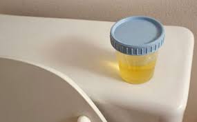 لون بول الحامل في الصباح وجنس الجنين 3a2ilati