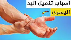 اسباب تنميل اليد اليسرى youtube