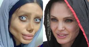 Angelina jolie has undergone several surgeries on her face and these photos prove it · the renowned actress has undergone surgery to undergo cosmetic operations . Teenager Joked About Undergoing Plastic Surgeries 50 Times To Look Like Angelina Jolie Small Joys