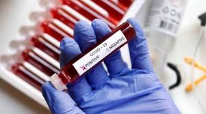 Singapore Lab Accidentally Disposes Of Covid 19 Swab Samples Meant For Testing World News The Indian Express