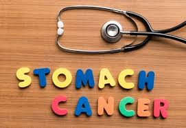 Stomach cancer or gastric cancer is the growth of abnormal cells in the lining of the stomach. How Endoscopy Detects Stomach Cancer Johns Hopkins Medicine