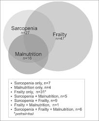 But it may also speed up as early as 65 or as late as 80. Do Malnutrition Sarcopenia And Frailty Overlap In Nursing Home Residents Springerlink