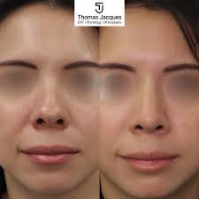 Thomas Jacques (@mrthomasjacques) · London