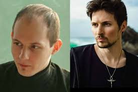 Kak Pavel Durov Izmenil Vneshnost Peresadka Volos Plasticheskie Operacii I Cvetnye Linzy Palach Gadzhety Skidki I Media