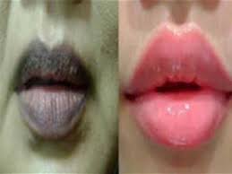 We did not find results for: Akak Jom Merahkan Bibir Secara Alami Selamat Tinggal Bibir Hitam Dunia Wanita Wanita Lelaki Forum Cari Infonet