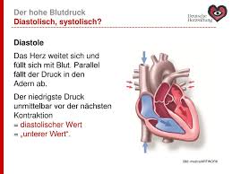 Bluthochdruck Was Tun Ppt Herunterladen