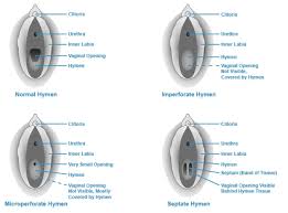 Girls virginia body part actually showing. Vagina Chronicles The Hymen