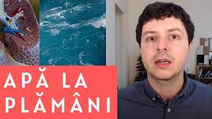 Buna ziua, de cateva zile am fost diagnosticat cu apa la plamani, jumatate din lobul drept are apa, nu am durere, nu tusesc, nu am febra, doar obosesc repede, ma intereseaza daca apa poate dispare prin tratament, eventual naturist sau doar trage cu seringa, si daca acest lucru se poate face doar la. Apa La PlÄƒmani Pleurezie Ce Este Simptome Cauze Tratament Youtube