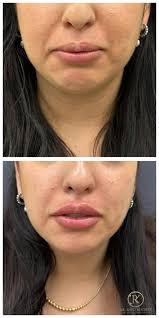 ד"ר ראיד חורי -המרכז לרפואת עור ,אסתטיקה ולייזר