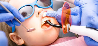 General Dental Fillings in White Rock & South Surrey