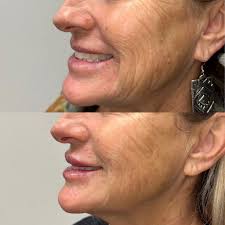 Profile for Fancy Aesthetics Med Spa