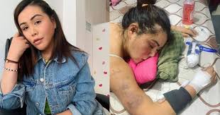 Su constante actividad en redes, en ocasiones, levanta una que otra crítica. Yina Calderon Mostro El Resultado De Su Ultima Cirugia Protagonista