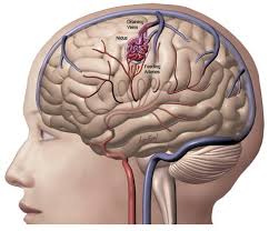 Neurosurgical Programs