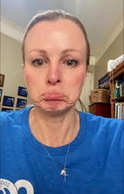 Can't make outgoing calls with call barring on?