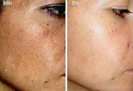 Pin On Beauty Tips
