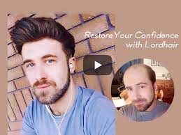 Una domanda che è spesso oggetto di discussione è: Protesi Capelli Prezzi Off 60 Www Loverethymno Com