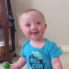 Fox Cities Down Syndrome Awareness Walk 2016