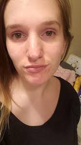 It's my first time using home tester club and I've been sent the cetaphil  cleanser. For my before and after photo does it have to be of my entire  face? Or can