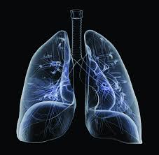 Check spelling or type a new query. Bronchite Aigue Planete Sante