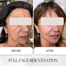 Discover our latest anti-aging treatments designed to rejuvenate your skin  and restore your youthful glow. ✨ Here's an updated list of our services.  🤍 Book your exclusive appointment with us today by