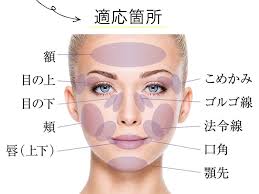 池袋東口院の若返りモニター募集 no 065 0009 美容整形 美容外科の湘南美容クリニック 美容クリニック 美容整形 美容