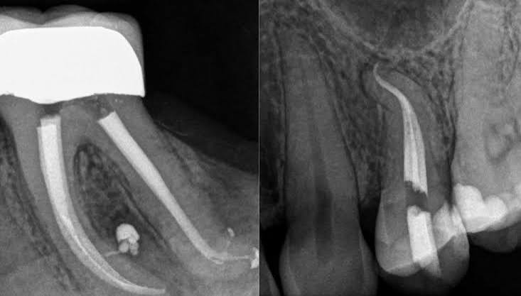 endodonti uzmanı istanbul