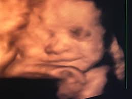 Fundraiser for Annette Harrell by Feleshia Hood : Denver Joe Memorial Fund