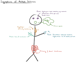 What Is Multiple Sclerosis Article Khan Academy