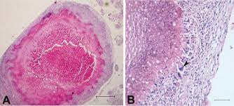 Outbreak of Avian Tuberculosis in Commercial Domestic Pekin Ducks (Anas  platyrhynchos domestica)