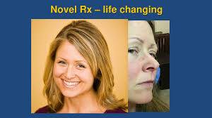 Mast Cell Activation Syndrome (MCAS)