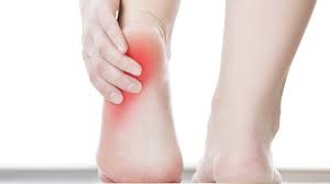 A bone spur (also called osteophyte) is a bone development that forms on bone or near a cartilage or tendon. Heel Spurs Symptoms Causes And Prevention