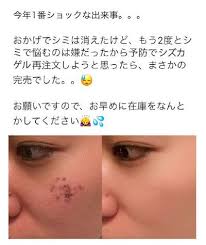 inpop ニューヨーカー maiトレンド 医薬品 医療技術 シミ