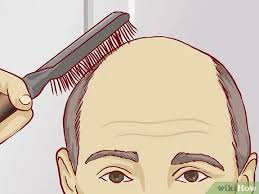 Because unless you are going to completely shave your head every week people are going to notice you're bald on top with a horseshoe around the sides and back. How To Know If You Have Male Pattern Baldness 9 Steps
