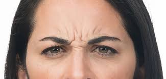 See more from patient 13144. Real Results Botox Cosmetic