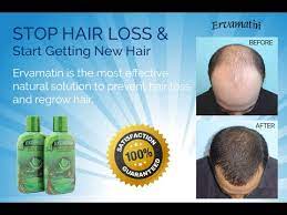 The ervamatin hair lotion provides effective and fast therapy for hair loss and its treatment ensures excellent therapeutic results. Ervamatin Hair Lotion Singapore Posts Facebook