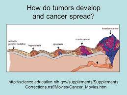 If you are really determined to get cancer here's how you can increase your chances. Outline What Is Cancer How Do People Know They Have Cancer Ppt Download