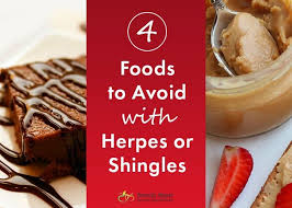 Pin On Shingles Ebv Herpes Recurring Outbreaks Post Herpetic Complications