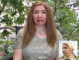 Folligraft Ve Sac Hastaliklari Nova Hair Sac Sac Dokulmesi