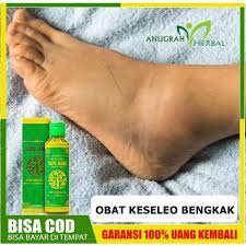 Jika anda mengalami sakit keseleo(terkilir) sampai membengkak? Terbaru Obat Minyak Gosok Untuk Keseleo Tangan Bengkak Obat Kaki Bengkak Minyak Sapu Jagat Shopee Indonesia